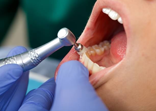 Best Wisdom Tooth Removal  in West Salem, OH